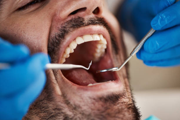 Best Emergency Broken Tooth Repair in Smackover, AR