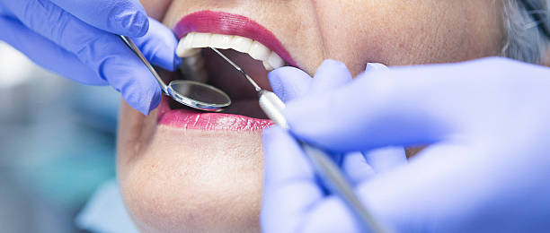 Best Emergency Wisdom Teeth Removal in Smackover, AR