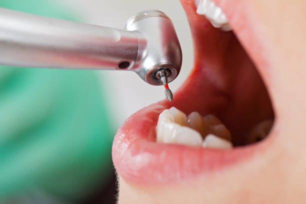Best Emergency Treatment for Toothache in Smackover, AR